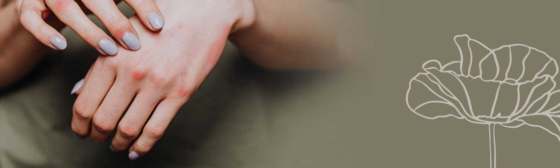 Hand-voetsyndroom door chemotherapie